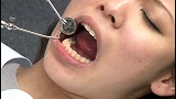 歯医者でごっくん...thumbnai3