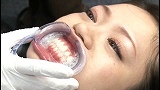 歯医者でごっくん...thumbnai7
